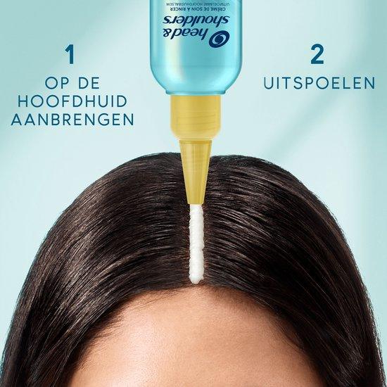 Head & Shoulders Baume apaisant pour le cuir chevelu DERMAxPRO Hydratant 145 ml