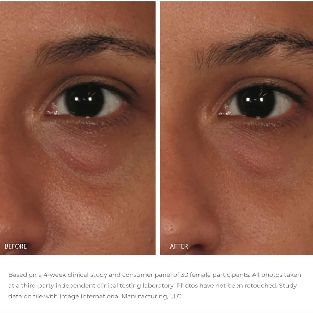 Image Skincare ORMEDIC - Balancing Eye Lift Gel 15 ml - K Drogerie